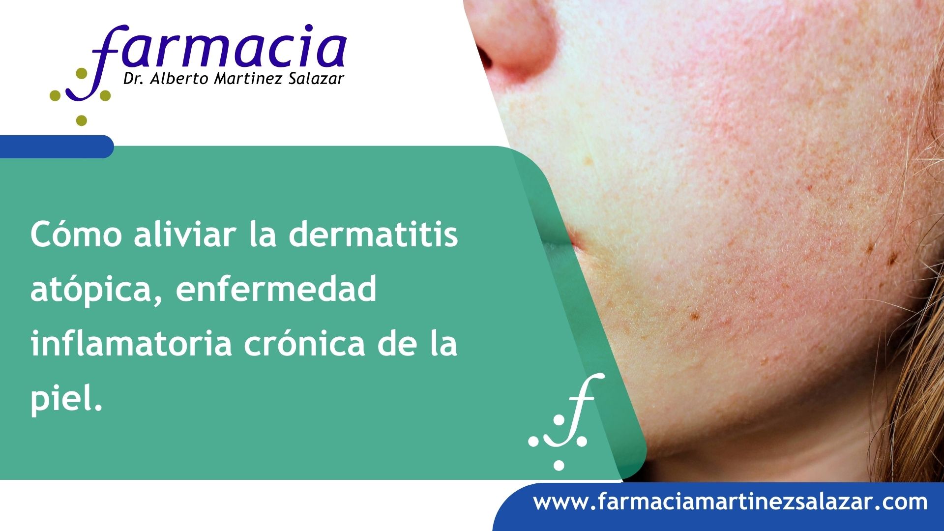 Cómo aliviar la dermatitis atópica Farmacia Martínez Salazar
